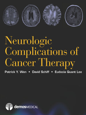 cover image of Neurologic Complications of Cancer Therapy